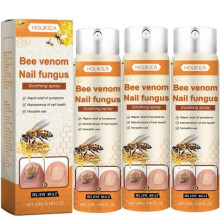 (3pcs) Nagelreparaturserum mit Bienengift & Spray gegen eingewachsene Zehennägel