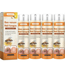 (4pcs) Nagelreparaturserum mit Bienengift & Spray gegen eingewachsene Zehennägel