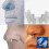 (XL) 12pcs Professional Anti-Snoring Devices Snore Stop Solution 4