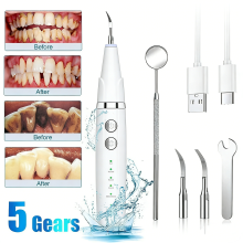 Ultrasonic Dental Calculus Plaque Remover Teeth Stains Cleaner Scaler White
