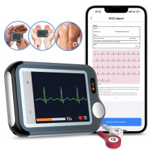 Mobile ECG Heart Monitor AI AFib Smartphone