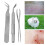 Efficient Bug Removal Tweezers 3 Pack Steel 1