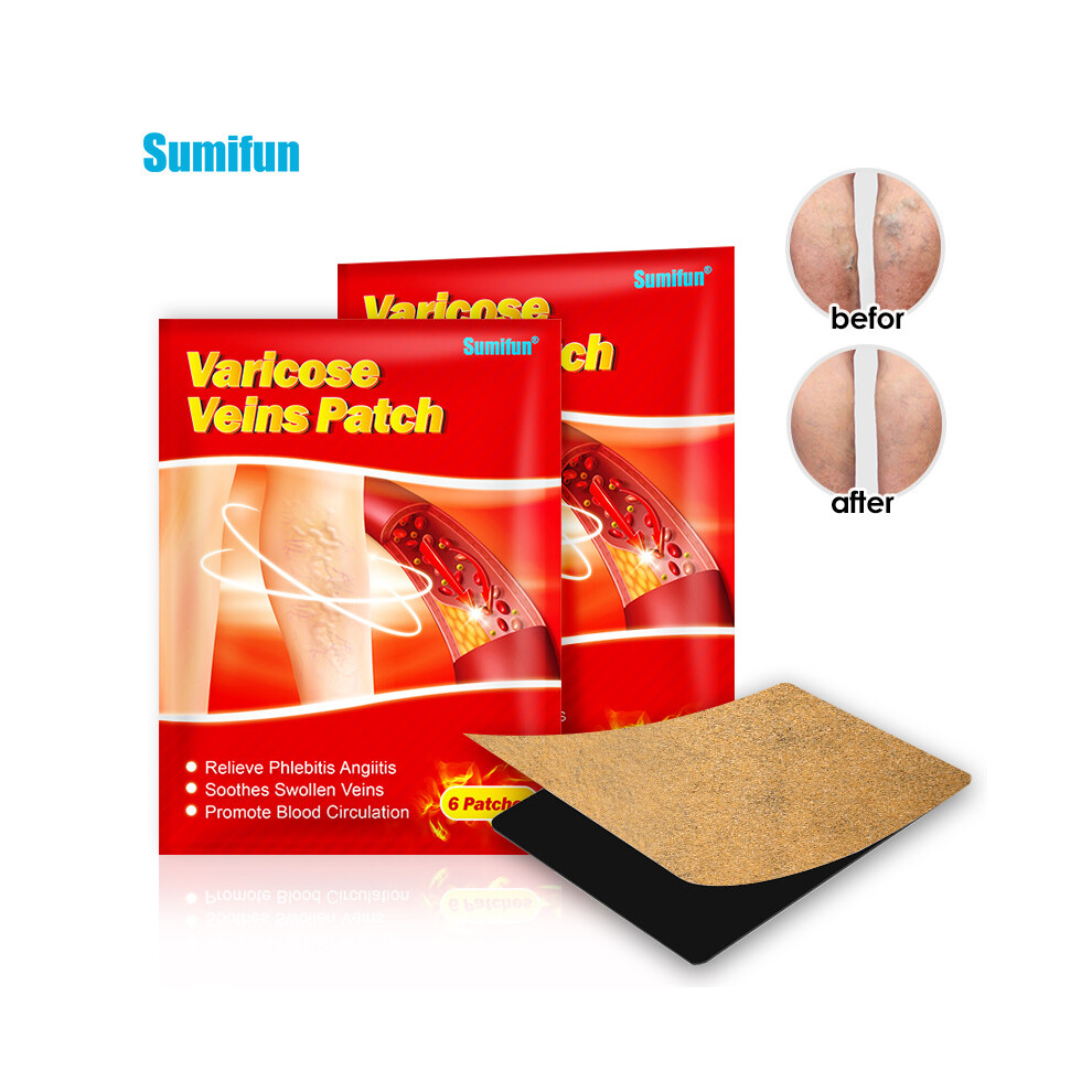 Vein Black Plaster Patch, Pulse Patch, Leg External Patch