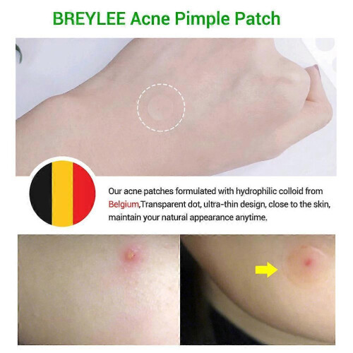 Tea Tree Acne Pimple Patch Pimple Removal Sticker Skin Care Patch 2