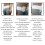 Cinturón protector inguinal para adultos con hernia, color: blanco. 4
