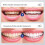 (3pcs) Livfresh Toothpaste Gel, Clinically Proven To Remove Plaque 250% Better 5