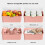 Implicit Pink Baby Bottle Drying Rack with Cover 4