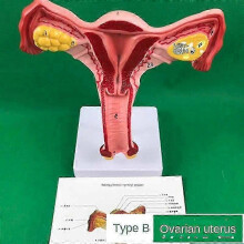 (B) Ovary And Uterus Dissection Pathology Female Uterus Teaching Anatomy Lesion Uterus