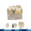 (Red) Implant Model Crown Bridge Demonstration Class Education Studying Teeth Model 4