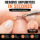 Blackhead Remover Tool Kit | Pimple Popper Spot Extractor Comedone Set 7 Piece 3