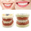 (Style B, 33 teeth) Dental Demonstration Teeth Model With All Removable Teeth Standard Study Teach 2