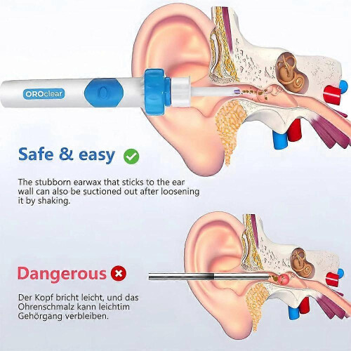 Oroclear Earwax Remover, Electric Ear Cleaner, Oroclear Ear Wax suction Remover 2