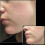 Adjustable Microneedle Derma Stamp compatible with Hair Growth 3