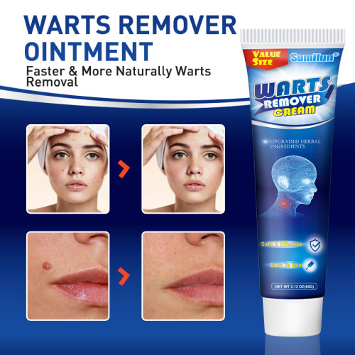 Verbeterde wrattendodende crème 2