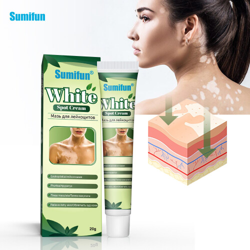 Crème de soin pour la peau Vitiligo Cream 1