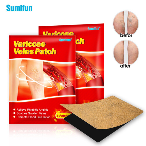 Patch de plâtre noir veineux, patch d'impulsion, patch externe de jambe