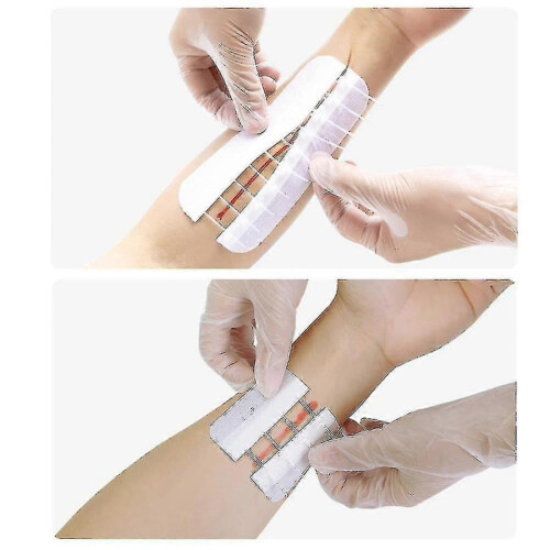 Zipper Band-aid Painless Wound Closure Device - 4/10pcs Pack 1