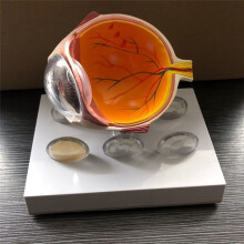 Oogbolmodel Demonstratie Menselijk Oog Glaucoom Cataract Anatomie Medisch Leermiddel Oogbollaesiemodel
