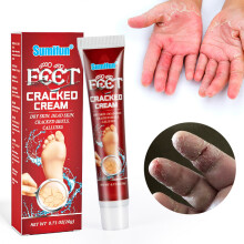 Crema para manos y pies agrietados Crema para el cuidado de la piel agrietada en frío