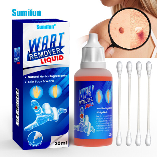 Solution d'élimination des verrues, solution de soins de la peau, aplatissement des verrues, élimination des cors, solution 1