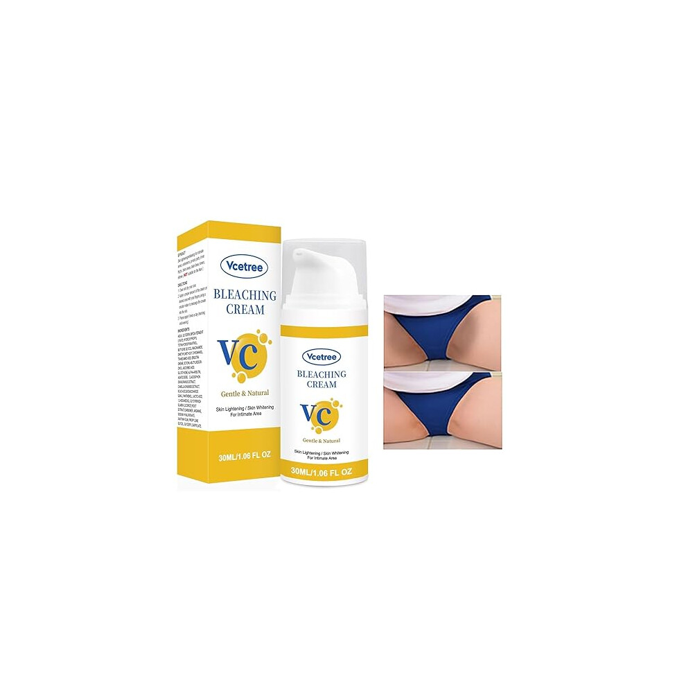 Cream/Dark Skin Lightening For Intimate & Body Areas, Spot Remover 1Oz
