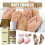 (1PCS) Anti-Fungal Treatment Spray 3