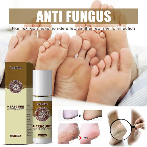 (1PCS) Anti-Fungal Treatment Spray 2