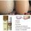 (1PCS) Anti-Fungal Treatment Spray 5
