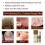 (2PCS) Anti-Fungal Treatment Spray 3