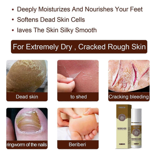 (2PCS) Anti-Fungal Treatment Spray 2