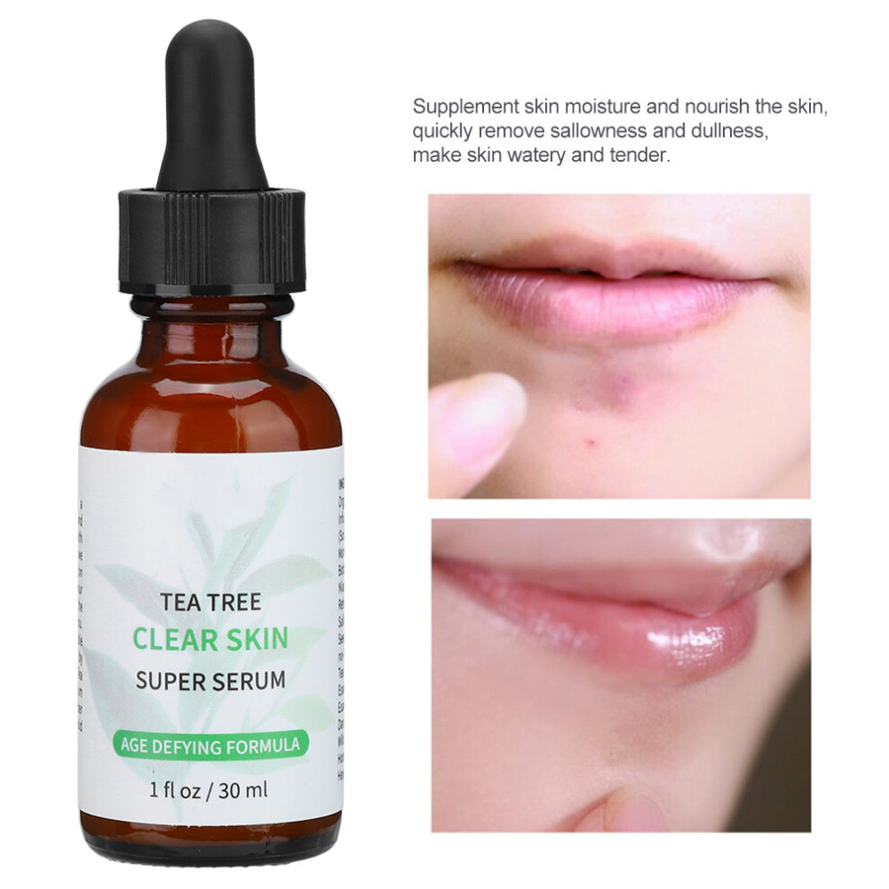 Tea Tree Oil Facial Serum 30ml for Pores & Pimples