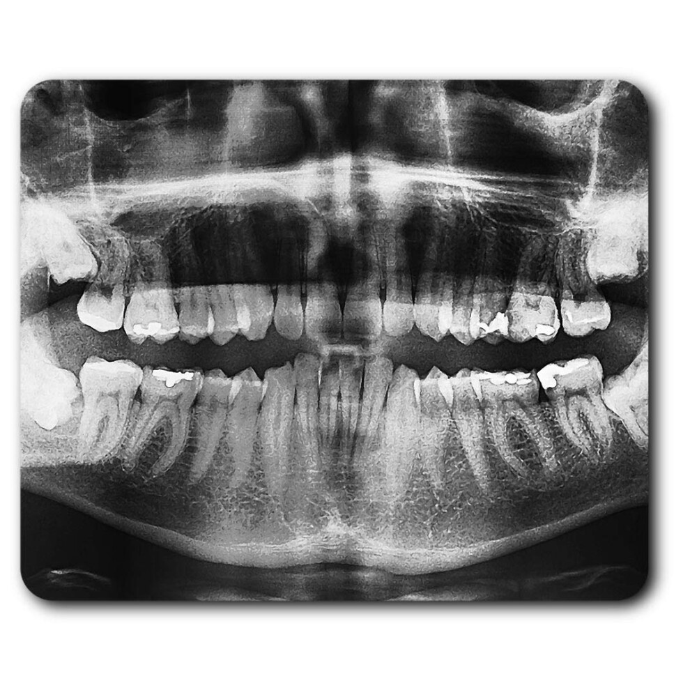 Destination Vinyl Ltd Dental Teeth X-Ray Dentist Dental Mouse Mat Pad Computer Pc Laptop Gaming Office Home Desk Accessory Gadget #42795 7626017493777