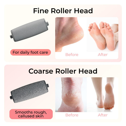 BarberBoss Electric Foot File, Callus Remover 2