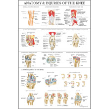 Palace Learning Laminated Anatomy and Injuries of the Knee Poster - Knee Joint Anatomical Chart - 18" x 24"