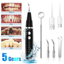 (Black) Ultrasonic Dental Calculus Plaque Remover Teeth Stains Cleaner Scaler