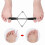 Hallux valgus teenscheider en -corrector voor hersteltraining 4
