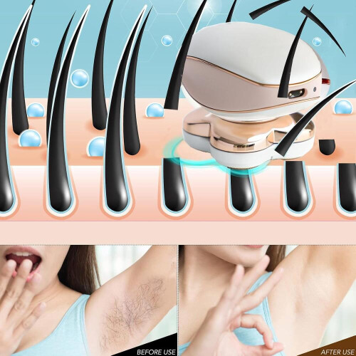 Αποτριχωτική λοσιόν Finishing Touch Flawless Legs για γυναίκες 2