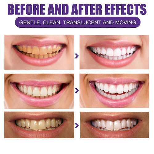 Teeth Colour Corrector Powder, Brightening Teeth Clean Tooth Toothpaste Powder 2