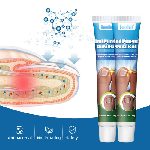 Onychomycosis Care Ointment Jiagoukang Ointment 2