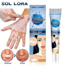 Vitiligo Skin Repair Cream,vitiligo Treatment Cream, Dispose Of White Spots On Skin And Improve Skin Pigmentation