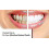 Premium Disposable Cigarette Filters with Advanced Filtration System 4