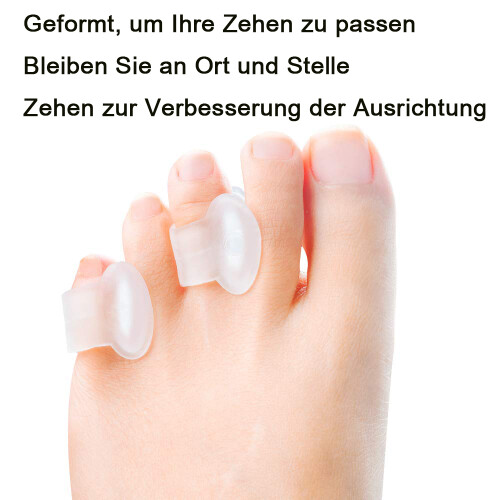 Καινοτόμα διαχωριστικά δακτύλων Pinky Toe, διαχωριστικό δακτύλων με τζελ για την 2