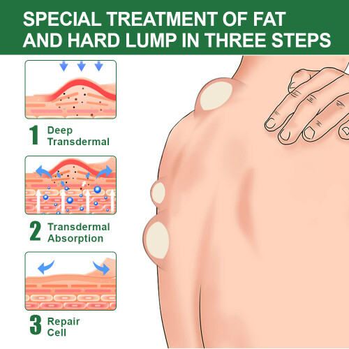 Coconut Oil Fat Fat Cream Fat Granule Subcutaneous Fat Agglomeration Massage Cream 2