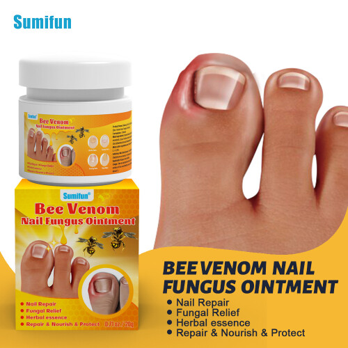 Jiagoukang Bee Venom Onychomycosis Care Cream