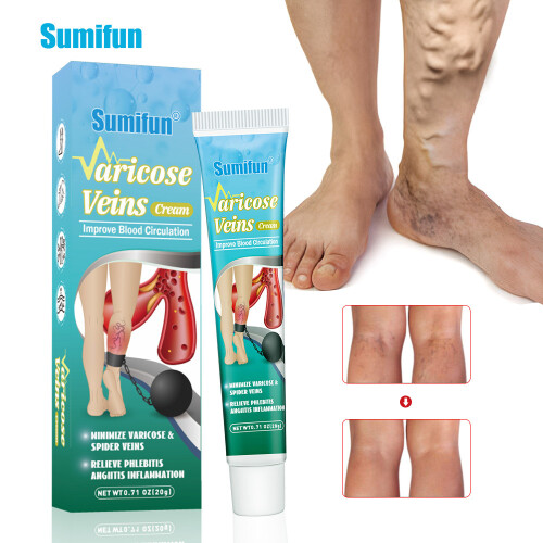 Maikang Cream Leg Vein Massage Cream