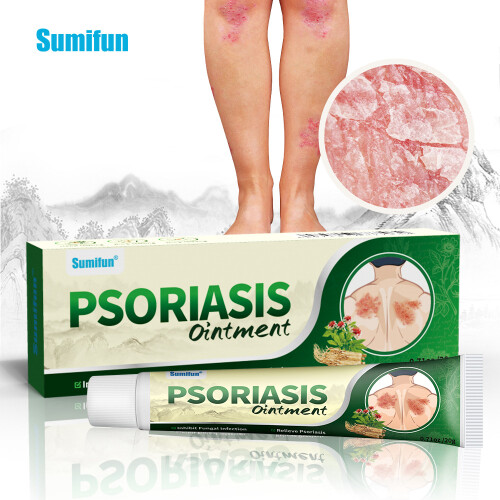 Herbal Anti-itch Cream For Skin Care 1