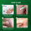 Herbal Anti-itch Cream For Skin Care 5