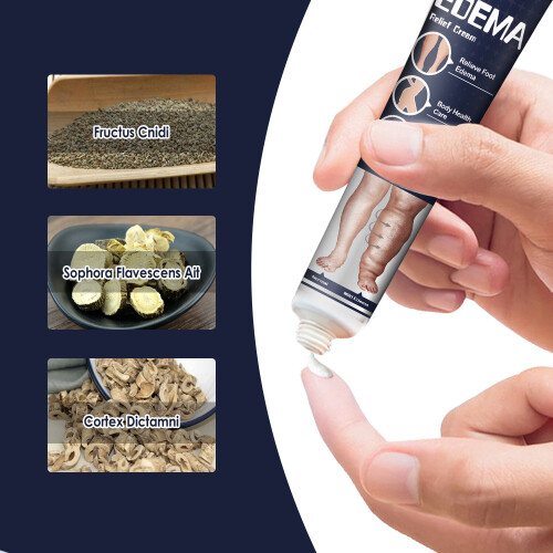 Oedeemcrème, Baggergezondheidscrème, Beenoedeemmassage 2