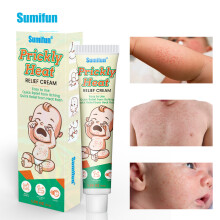 Prickly Heat And Itching Cream For Children With Summer Sweat And Prickly Heat Skin Care