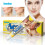 Acne Care Cream Skin Care Cream 1